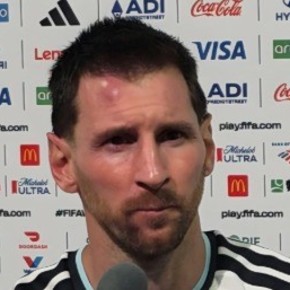 El tremendo chichón con el que terminó Messi el partido ante Cabo Verde