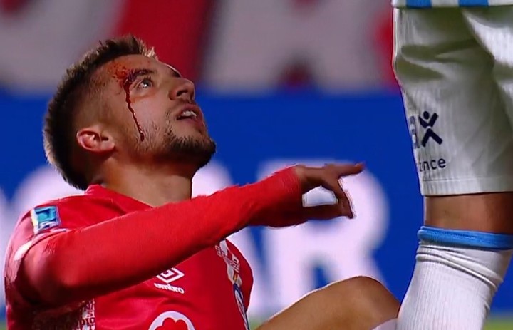 Gutiérrez perdió sangre cuando le pegó Maravilla Martínez.
